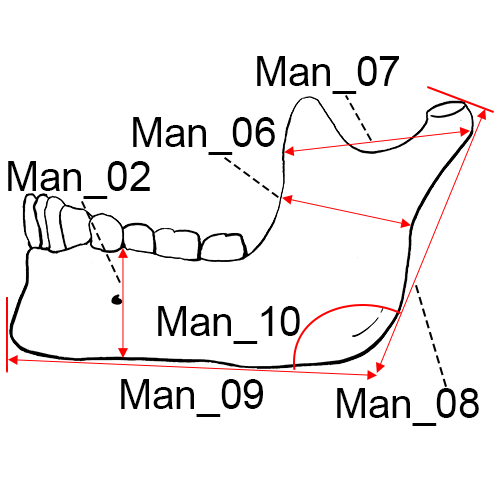 Mandible